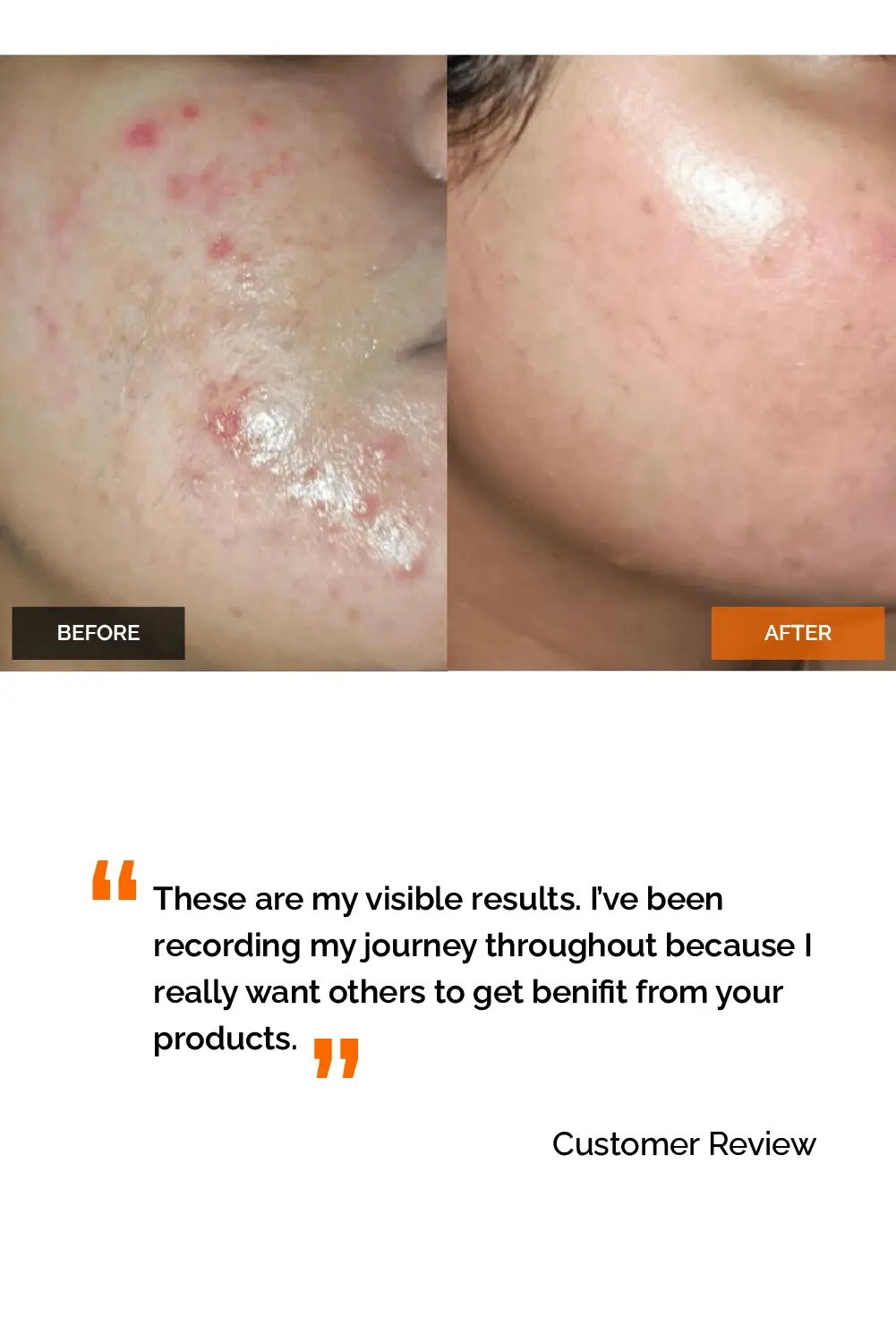 Salicylic Acid 2% Serum - Image 5